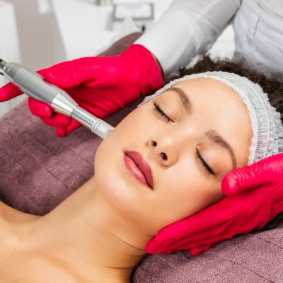 Microneedling Before and After Care Tips for Effective Results