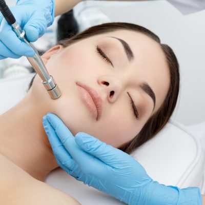 What are the Side Effects of Microdermabrasion