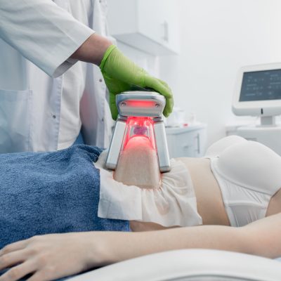 What is the Time Duration of CoolSculpting